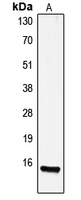 1 - Anti-Gastrin Antibody AP51223