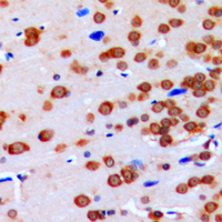 19 - Anti-GBP3 Antibody AP51224