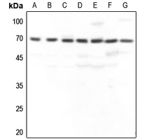 1 - Anti-GBP3 Antibody AP51224