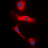 3 - Anti-Glucagon Antibody AP51225