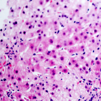 19 - Anti-Glucagon Antibody AP51225