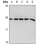 1 - Anti-Glucagon Antibody AP51225