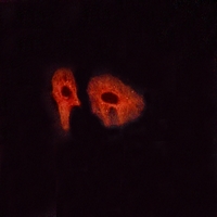 3 - Anti-Glucagon Receptor Antibody AP51226