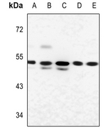 1 - Anti-Glucagon Receptor Antibody AP51226