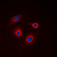 3 - Anti-GCNT7 Antibody AP51227
