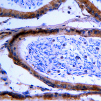 19 - Anti-GCNT7 Antibody AP51227