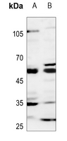 1 - Anti-GCNT7 Antibody AP51227
