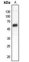1 - Anti-GDI1 Antibody AP51228