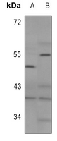 1 - Anti-GHRH Receptor Antibody AP51229