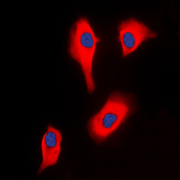3 - Anti-Glycerol Kinase 2 Antibody AP51231