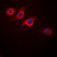 3 - Anti-GLP-1 Receptor Antibody AP51232