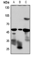 1 - Anti-GLP-1 Receptor Antibody AP51232
