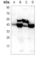 1 - Anti-Glutamine Synthetase Antibody AP51233