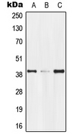 1 - Anti-GPR174 Antibody AP51239