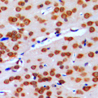 19 - Anti-GPRIN2 Antibody AP51244