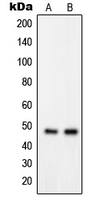 1 - Anti-GPRIN2 Antibody AP51244