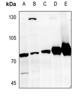 1 - Anti-GRK6 Antibody AP51246