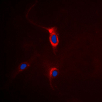 3 - Anti-mGLUR4 Antibody AP51247