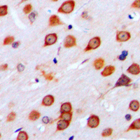 19 - Anti-mGLUR4 Antibody AP51247