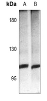 1 - Anti-mGLUR4 Antibody AP51247