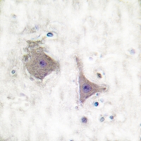 19 - Anti-mGLUR7 Antibody AP51248