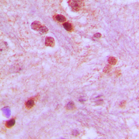 19 - Anti-GTF3C3 Antibody AP51250
