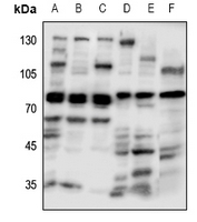 1 - Anti-GUCY1A3 Antibody AP51251