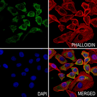 3 - Anti-GUCY1B2 Antibody AP51252