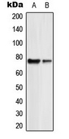 1 - Anti-GUCY1B2 Antibody AP51252