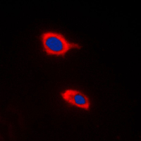 3 - Anti-HCCS Antibody AP51254