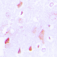 19 - Anti-HCCS Antibody AP51254