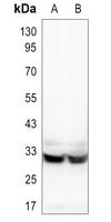 1 - Anti-HCCS Antibody AP51254