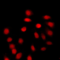 3 - Anti-Histone H4 (Acetyl-K12) Antibody AP51256