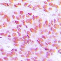 19 - Anti-Histone H4 (Acetyl-K12) Antibody AP51256