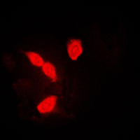 3 - Anti-hnRNP A1 Antibody AP51259