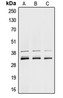 1 - Anti-hnRNP A1 Antibody AP51259