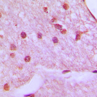 19 - Anti-HOXA1 Antibody AP51262