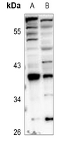 1 - Anti-HOXA1 Antibody AP51262