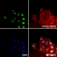 3 - Anti-HOXB2 Antibody AP51264