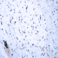 19 - Anti-HOXB2 Antibody AP51264