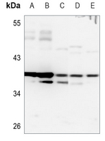 1 - Anti-HOXB2 Antibody AP51264