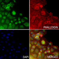 3 - Anti-HOXB5 Antibody AP51265