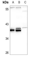 1 - Anti-HOXB5 Antibody AP51265