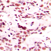 19 - Anti-HOXB9 Antibody AP51266