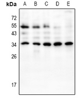 1 - Anti-HOXB9 Antibody AP51266