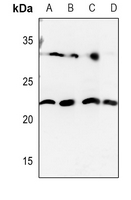 1 - Anti-HOXD12 Antibody AP51267