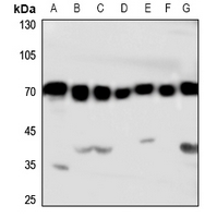 1 - Anti-HSC70 Antibody AP51269
