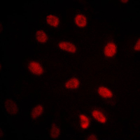 3 - Anti-GRP75 Antibody AP51270