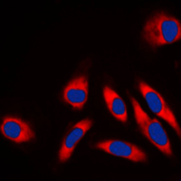 3 - Anti-HSP60 Antibody [KO/KD Validated] AP51271