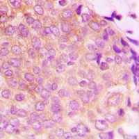 19 - Anti-HSP60 Antibody [KO/KD Validated] AP51271